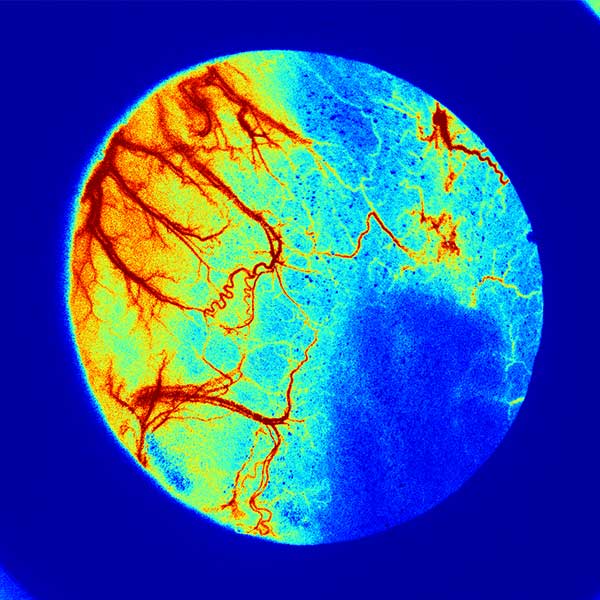 LSCI ZW Laser Speckle Contrast Imaging System