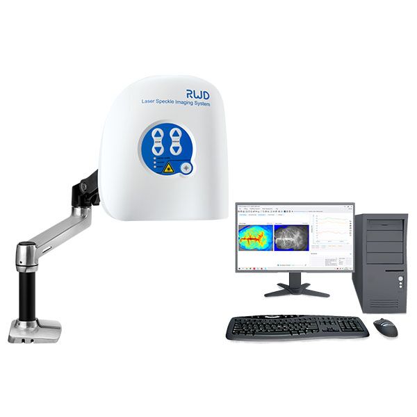 laser speckle contrast imaging lsci
