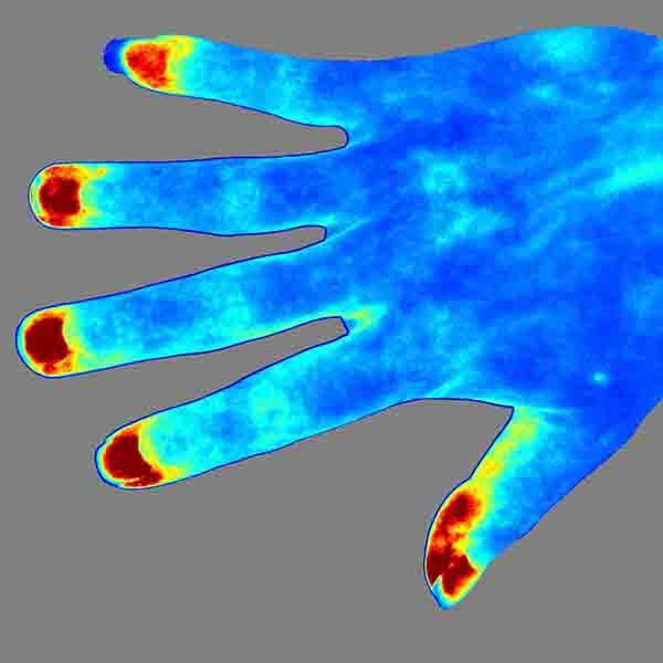 LSCI ZW Laser Speckle Contrast Imaging System