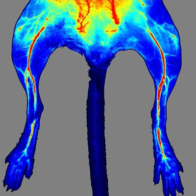What Is Included in a Standard Laser Speckle Imager Package?