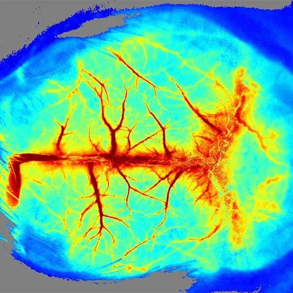 What Are the Applications of Laser Speckle Contrast Imaging in Ophthalmology?