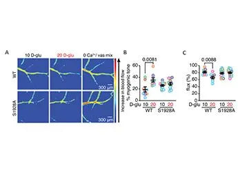 User Case: Laser Speckle Imaging System (LSCI),measure blood flow in cerebral arteries via a cranial window in anesthetized mice, to corroborate an in vivo physiological role for pS1928 upon HG