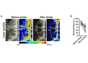 User Case: Laser Speckle Imaging System (LSCI), Corroborate haemodynamic changes within the targeted region on the ipsilateral side of the brain before and after stroke in the photothrombotic stroke model.