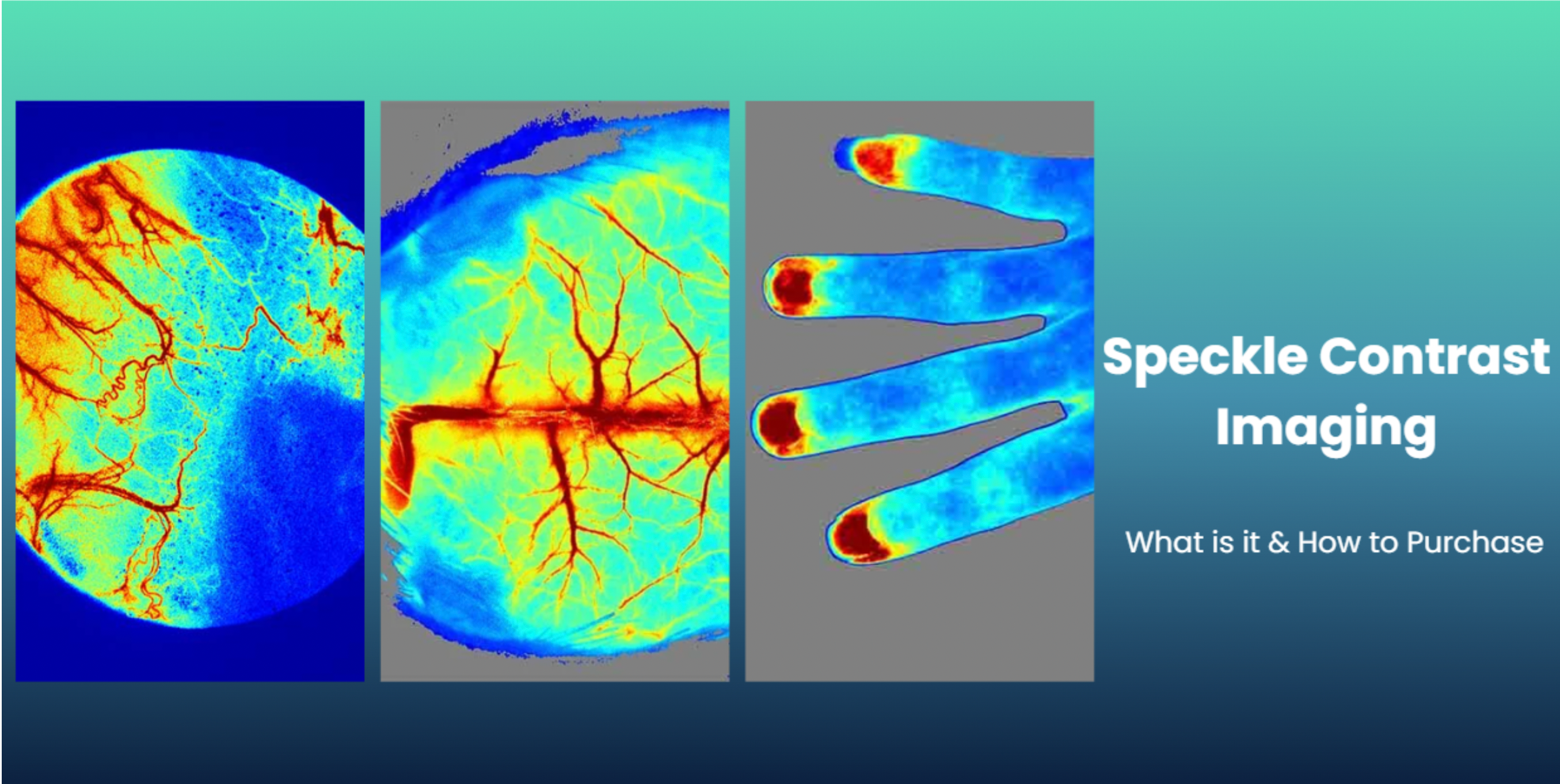 What is Laser Speckle Contrast Imaging, and How to Purchase?