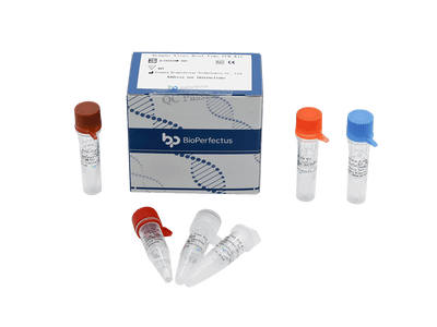BioPerfectus Dengue Virus Real Time PCR Kit
