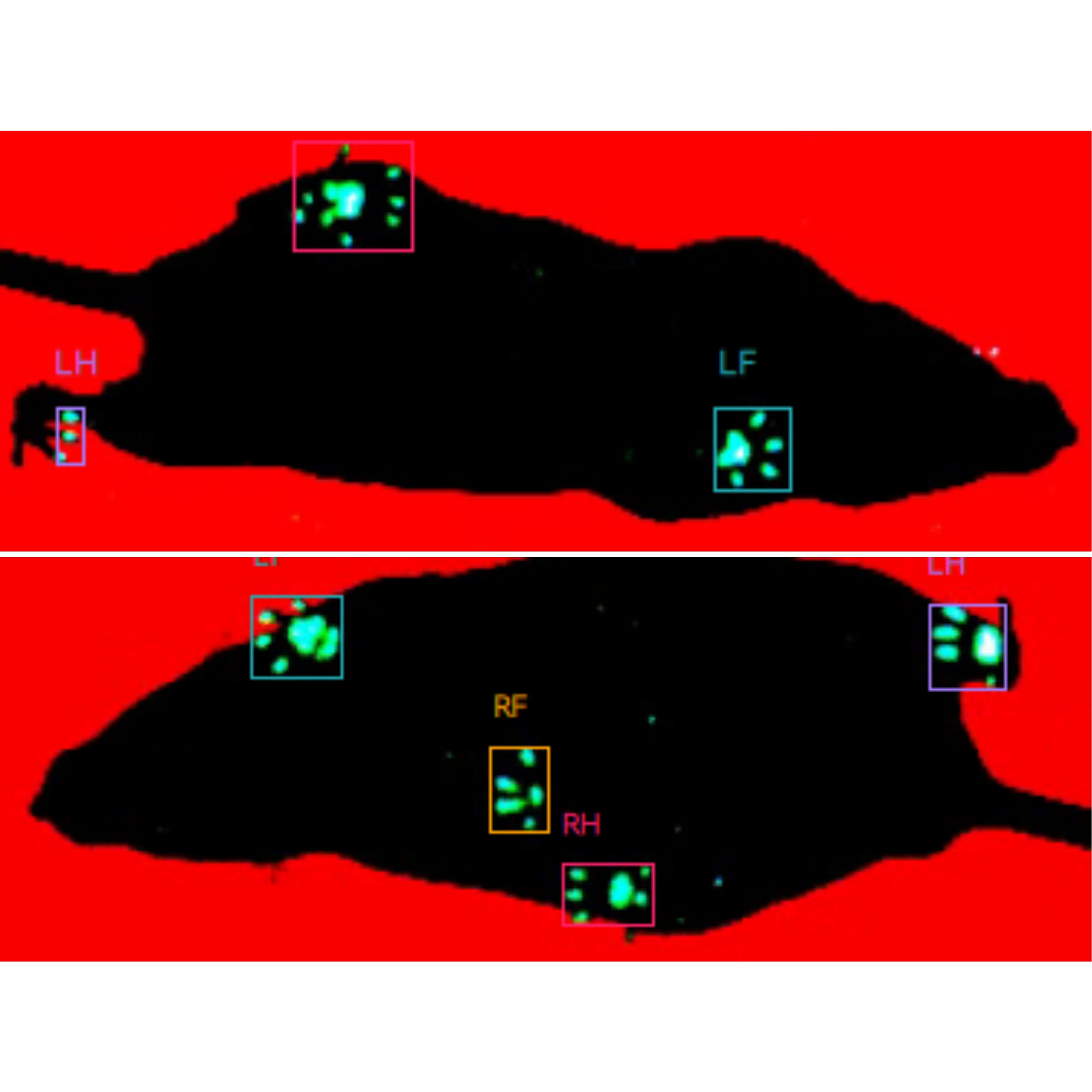 Techman Gait Analysis System