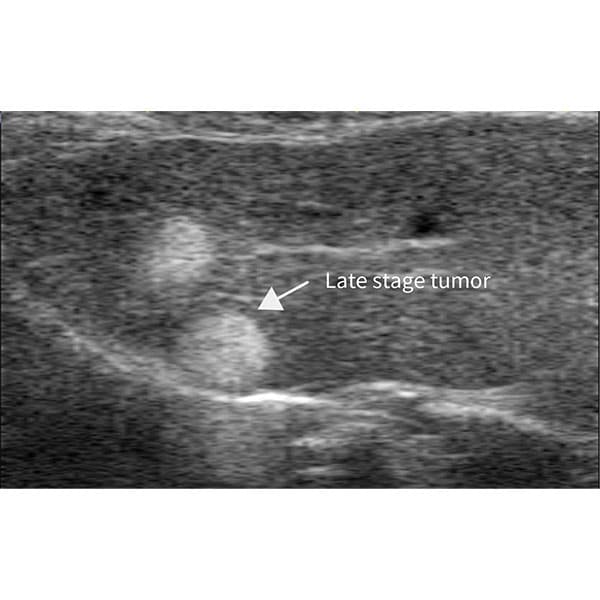 High Frequency Small Animal Ultrasound Imaging System (RevoSilex F30/ RevoSilex F60 )