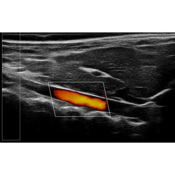 RWD High Frequency Small Animal Ultrasound Imaging System (RevoSilex F30/F60)
