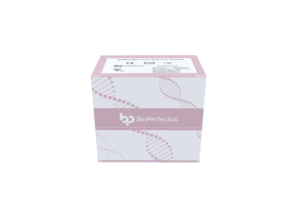 Epstein-Barr Virus Quantitation Real Time PCR Kit