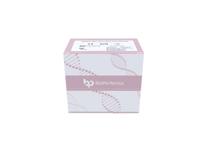 Epstein-Barr Virus Quantitation Real Time PCR Kit