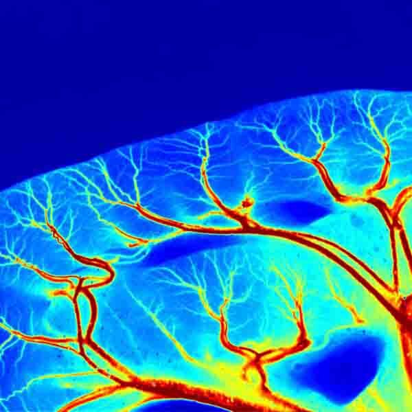 LSCI ZW Laser Speckle Contrast Imaging System